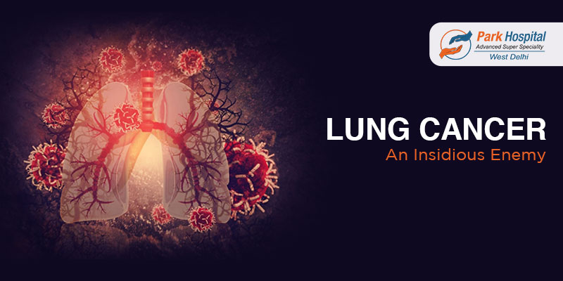 Lung Cancer: An Insidious Enemy